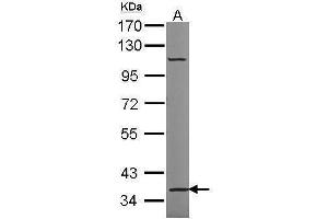 WB Image Sample (30 ug of whole cell lysate) A: HeLa 7. (TRIM27 Antikörper)