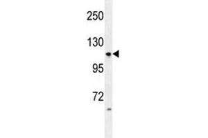 Anti-LGR5 antibody western blot analysis in HL-60 lysate (LGR5 Antikörper  (AA 605-638))