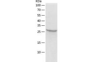 HPGD Protein (AA 1-266) (His tag)