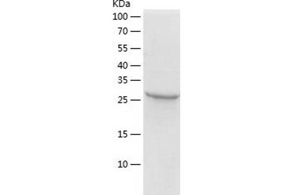 HPGD Protein (AA 1-266) (His tag)