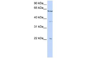 WB Suggested Anti-CSRP2 Antibody Titration:  0. (CSRP2 Antikörper  (C-Term))