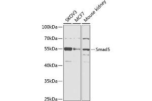 Western blot analysis of extracts of various cell lines, using Smad5 antibody (ABIN6128714, ABIN6148090, ABIN6148091 and ABIN6218232) at 1:1000 dilution. (SMAD5 Antikörper  (AA 186-465))