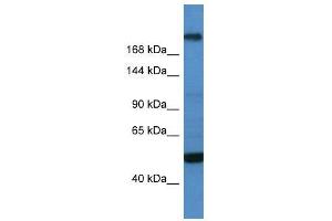 WB Suggested Anti-TCF20  Antibody Titration: 0. (TCF20 Antikörper  (C-Term))