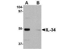 Image no. 1 for anti-Interleukin 34 (IL34) (Internal Region) antibody (ABIN342710) (IL-34 Antikörper  (Internal Region))