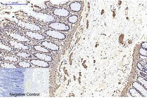 Immunohistochemical analysis of paraffin-embedded human colon tissue. (TUBB2A Antikörper)