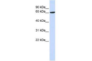 ADAM9 antibody used at 1 ug/ml to detect target protein. (ADAM9 Antikörper)