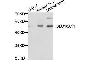 Western blot analysis of extracts of various cell lines, using SLC16A11 antibody. (SLC16A11 Antikörper)