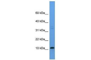 Western Blot showing Cyyr1 antibody used at a concentration of 1-2 ug/ml to detect its target protein. (CYYR1 Antikörper  (Middle Region))