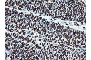 Image no. 9 for anti-O-Sialoglycoprotein Endopeptidase (OSGEP) (AA 1-335) antibody (ABIN1490751)