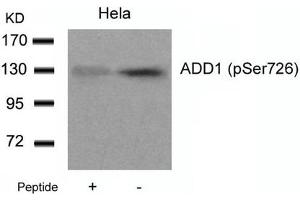 Western blot analysis of extracts from Hela cells using ADD1(Phospho-Ser726) Antibody and the same antibody preincubated with blocking peptide. (alpha Adducin Antikörper  (pSer726))