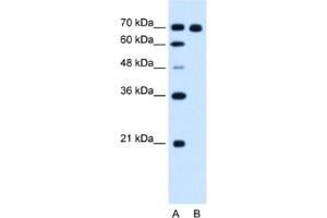 Western Blotting (WB) image for anti-Ribonucleotide Reductase M1 (RRM1) antibody (ABIN2462919) (RRM1 Antikörper)