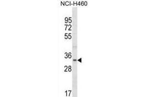 Western Blotting (WB) image for anti-Fibrillarin-Like 1 (FBLL1) antibody (ABIN5019815) (FBLL1 Antikörper)