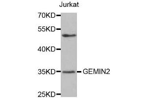 Western blot analysis of extracts of Jurkat cells, using GEMIN2 antibody. (SIP1 Antikörper)
