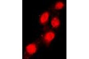 Immunofluorescent analysis of TEAD1 staining in Raw264. (TEAD1 Antikörper  (Center))