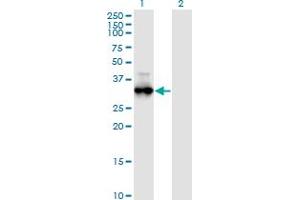 Western Blot analysis of PRKG1 expression in transfected 293T cell line by PRKG1 monoclonal antibody (M01), clone 5E5. (PRKG1 Antikörper  (AA 73-170))