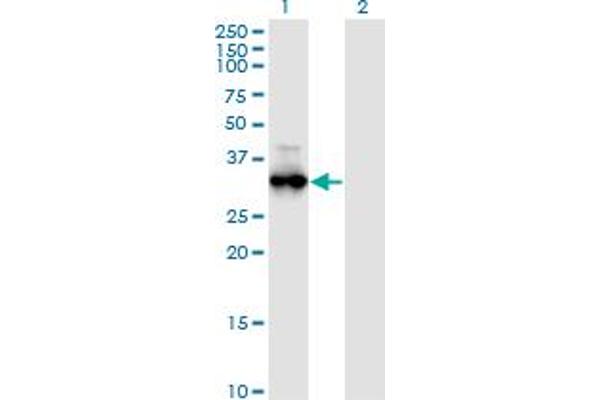 PRKG1 Antikörper  (AA 73-170)