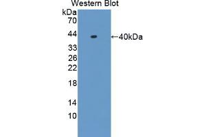 Western blot analysis of the recombinant protein. (HNRNPA1 Antikörper  (AA 2-320))