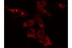 ABIN6275808 staining Hela cells by IF/ICC. (CYP4V2 Antikörper  (Internal Region))