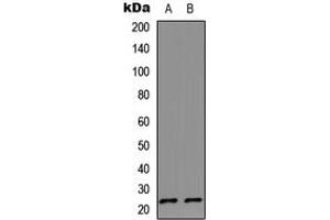 Western blot analysis of IL-17D expression in HeLa (A), Jurkat (B) whole cell lysates.