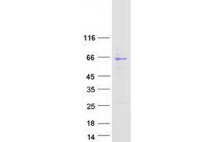 Western Blotting (WB) image for ATP-Binding Cassette, Sub-Family E (OABP), Member 1 (ABCE1) (Transcript Variant 1) protein (Myc-DYKDDDDK Tag) (ABIN2714266)