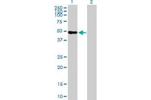 Western Blot analysis of WDR41 expression in transfected 293T cell line by WDR41 MaxPab polyclonal antibody. (WDR41 Antikörper  (AA 1-459))