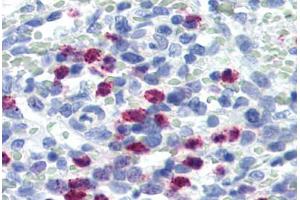 Human Spleen (formalin-fixed, paraffin-embedded) stained with FBXW7 antibody ABIN364303 at 5 ug/ml followed by biotinylated goat anti-rabbit IgG secondary antibody ABIN481713, alkaline phosphatase-streptavidin and chromogen. (FBXW7 Antikörper  (Internal Region))