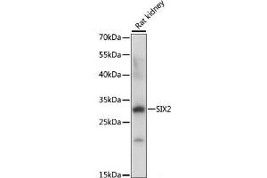 Western blot analysis of extracts of Rat kidney using SIX2 Polyclonal Antibody at dilution of 1:1000. (SIX2 Antikörper)