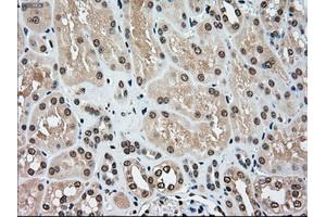 Immunohistochemical staining of paraffin-embedded Kidney tissue using anti-MAP2K4mouse monoclonal antibody. (MAP2K4 Antikörper)