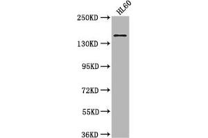 Western Blot Positive WB detected in: HL60 whole cell lysate All lanes: SMARCC2 antibody at 1:2000 Secondary Goat polyclonal to rabbit IgG at 1/50000 dilution Predicted band size: 133, 125, 127 kDa Observed band size: 170 kDa (SMARCC2 Antikörper  (AA 300-650))