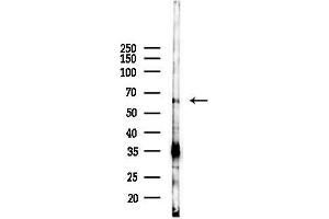 anti-FANCD2/FANCI-Associated Nuclease 1 (FAN1) antibody