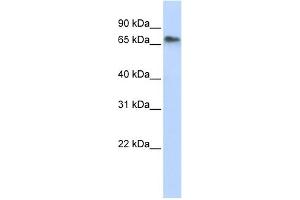 WB Suggested Anti-REPIN1 Antibody Titration:  0.
