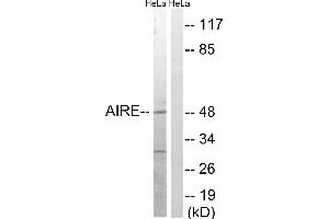 Western blot analysis of extracts from HeLa cells, treated with Hu (2nM, 24hours), using AIRE (Ab-156) antibody.