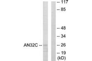 Western blot analysis of extracts from HuvEc cells, using ANP32C Antibody. (ANP32C Antikörper  (AA 121-170))