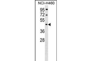 PLEKHA9 Antibody (C-term) (ABIN1537166 and ABIN2849723) western blot analysis in NCI- cell line lysates (35 μg/lane). (PLEKHA9 Antikörper  (C-Term))
