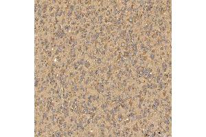 IHC analysis of Citrin/SLC25A13 using anti-Citrin/SLC25A13 antibody (ABIN7599512). (slc25a13 Antikörper  (AA 1-643))