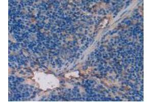 IHC-P analysis of Mouse Spleen Tissue, with DAB staining. (Thrombomodulin Antikörper  (AA 31-167))