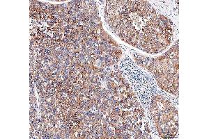 IHC analysis of EML4 using anti-EML4 antibody (ABIN6719384). (EML4 Antikörper  (AA 207-423))