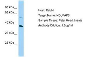 C20orf7 antibody  (AA 43-92)