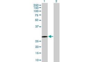 Western Blot analysis of HSD17B10 expression in transfected 293T cell line by HSD17B10 MaxPab polyclonal antibody. (HSD17B10 Antikörper  (AA 1-261))
