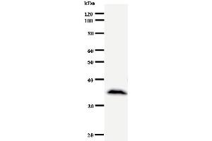 Western Blotting (WB) image for anti-Core-binding Factor, Runt Domain, alpha Subunit 2, Translocated To, 2 (CBFA2T2) antibody (ABIN930909)