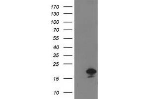 Western Blotting (WB) image for anti-Destrin (Actin Depolymerizing Factor) (DSTN) antibody (ABIN1497908) (Destrin Antikörper)