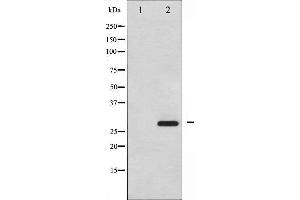 Western blot analysis of HSP27 phosphorylation expression in UV treated HeLa whole cell lysates,The lane on the left is treated with the antigen-specific peptide.