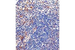 Immunohistochemical analysis of paraffin-embedded M. (LYN Antikörper  (AA 229-263))