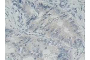 Immunohistochemistry (IHC) image for anti-Receptor Tyrosine Kinase-Like Orphan Receptor 2 (ROR2) (AA 683-934) antibody (ABIN7443737)