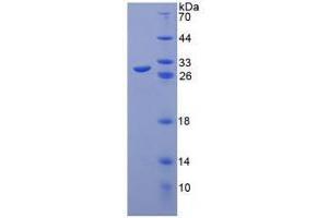 SDS-PAGE analysis of Human Toll Like Receptor 8 Protein. (TLR8 Protein)