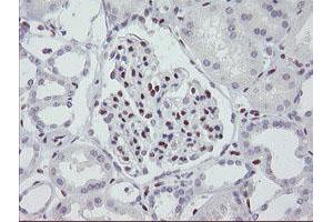 Image no. 1 for anti-Meis Homeobox 3 (MEIS3) (AA 1-261) antibody (ABIN1490670) (MEIS3 Antikörper  (AA 1-261))