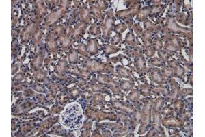 Used in DAB staining on fromalin fixed paraffin-embedded Kidney tissue (PARK7/DJ1 Antikörper  (AA 1-189))