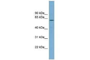WB Suggested Anti-RIOK2 Antibody Titration: 0. (RIOK2 Antikörper  (Middle Region))