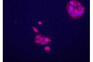 Immunofluorecence staining of anti-GPC3 Pab (cat (ABIN652202 and ABIN2840751)) on HepG2 cells. (Glypican 3 Antikörper  (C-Term))