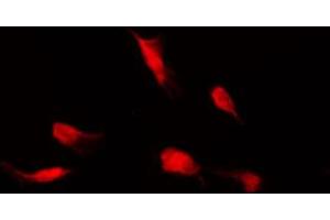 ABIN6267558 staining HeLa by IF/ICC. (HDAC4 Antikörper  (pSer632))